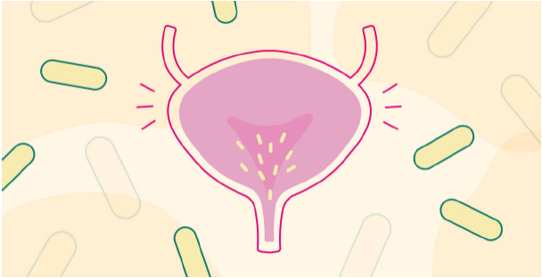 Traiter naturellement votre infection urinaire